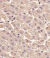 LYN Antibody (Center)